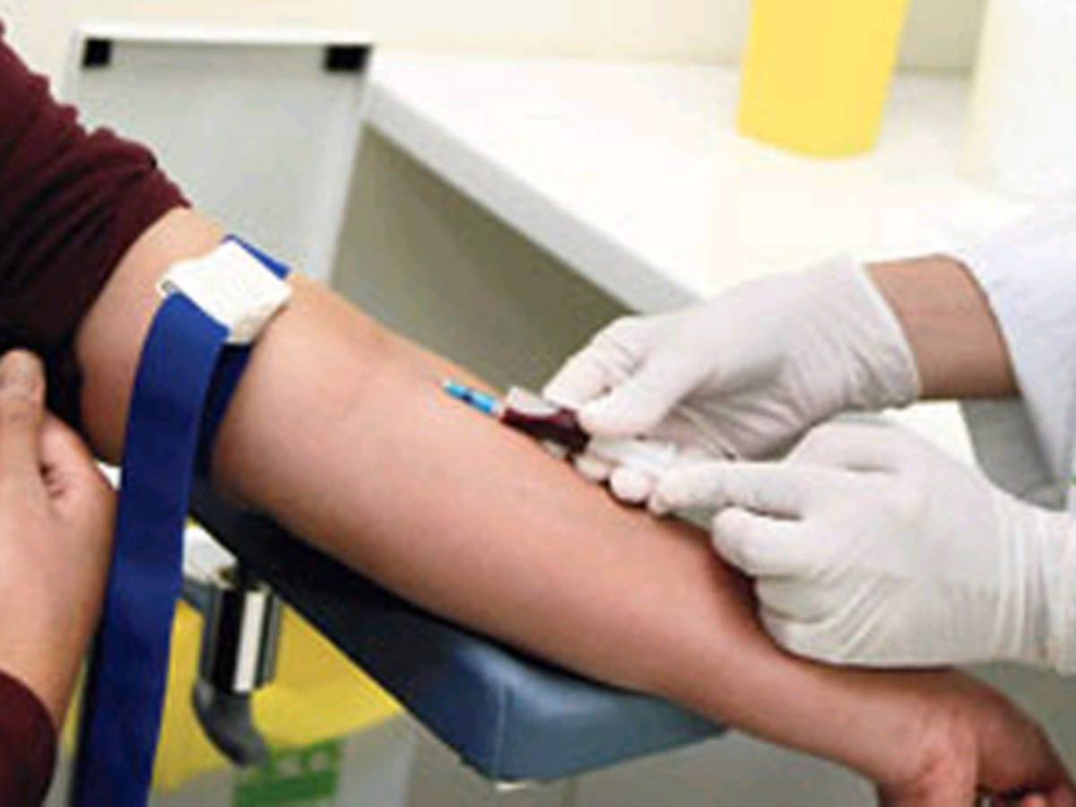 Top 9 Blood Tests to Keep You Healthy