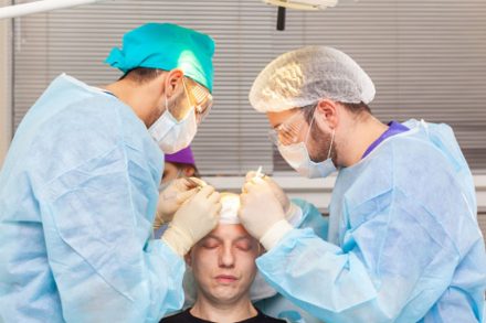 5 hair transplant secrets nobody will tell you 