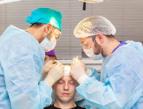 5 hair transplant secrets nobody will tell you 