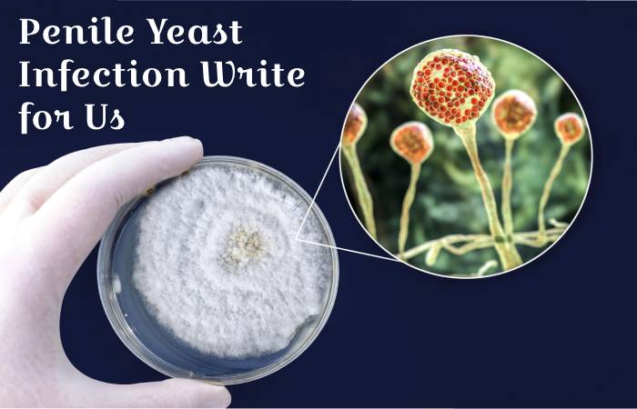 Penile Yeast Infection write for us