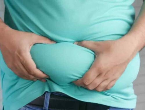 navigating weight loss surgeries