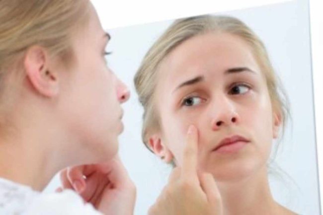 What is Body Dysmorphic Disorder